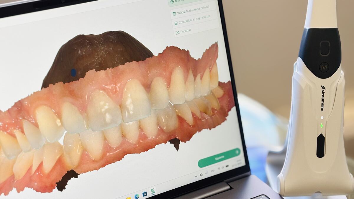3D Intraoral Scanning