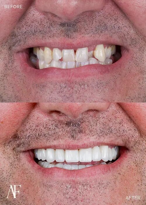 Comprehensive Oral Rehabilitation