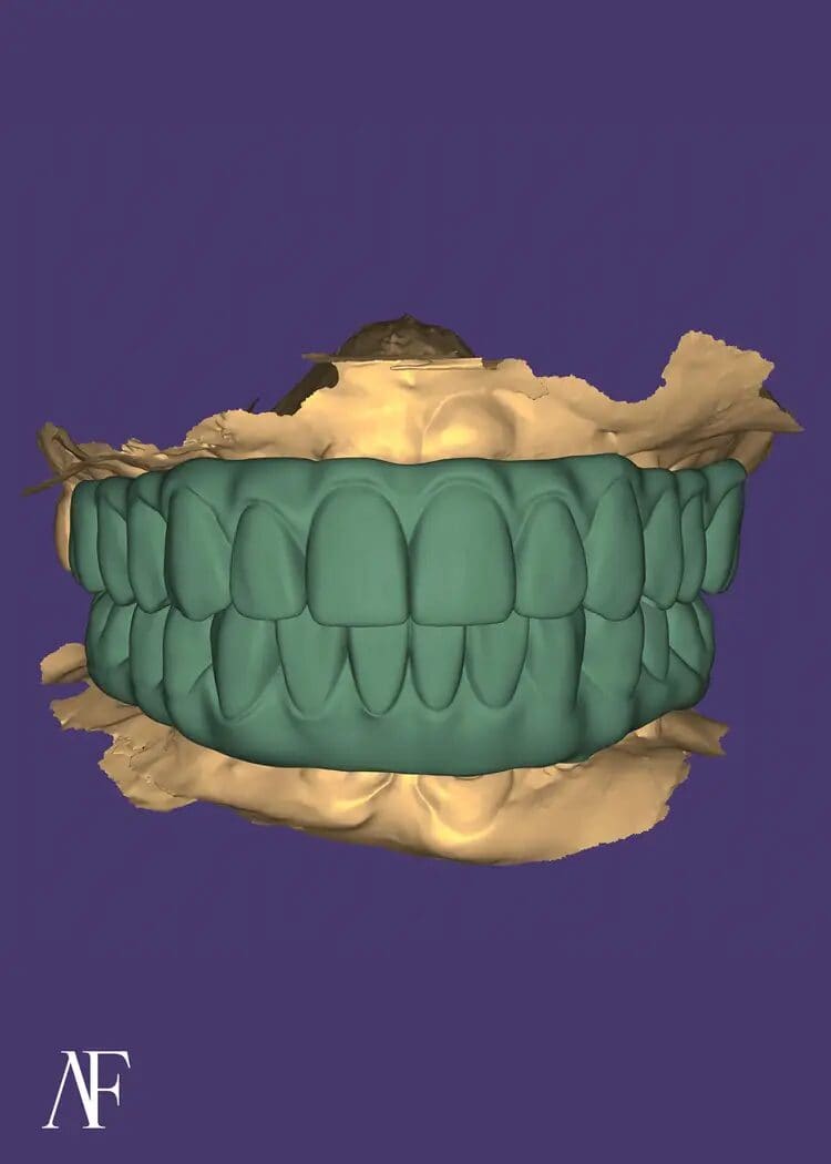 Digital Smile Design (DSD)