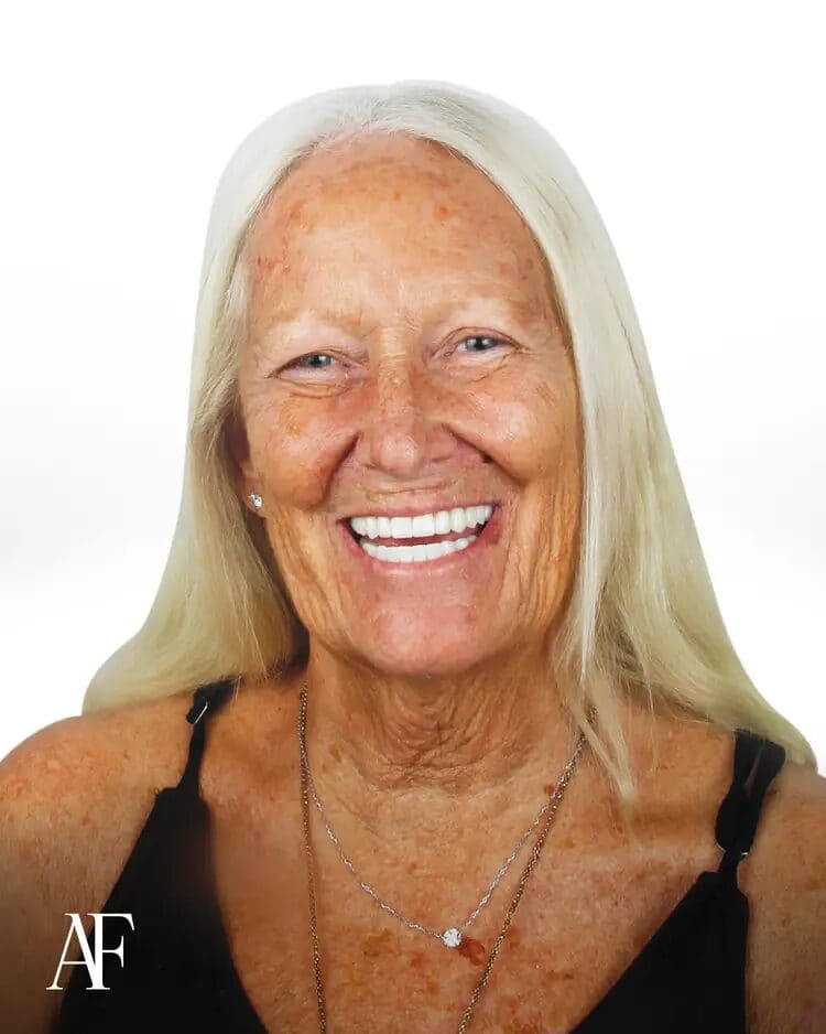 High-Durability Dental Implants